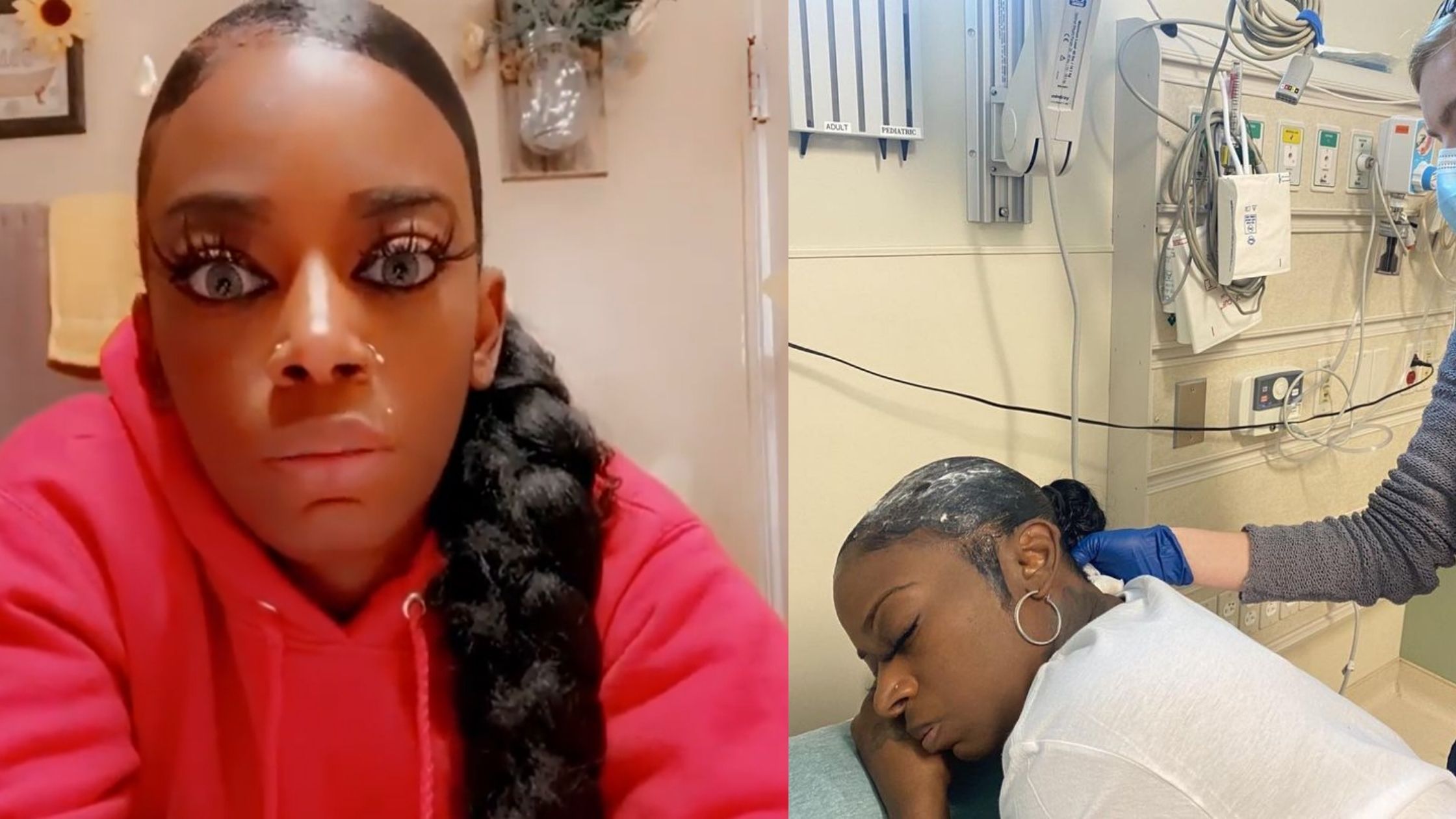 Louisana woman ends up in hospital after using Gorilla Glue instead of hair spray. Watch